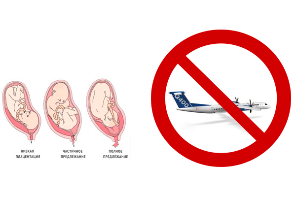 Как узнать, можно ли беременным летать на самолете?