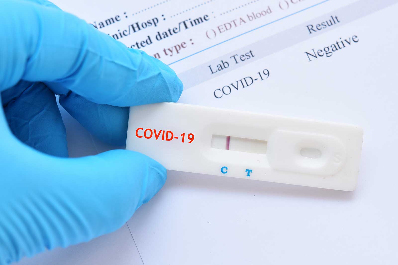 Лабораторные тесты на коронавирус covid-19 простым языком. как правильно выбрать метод исследования.
