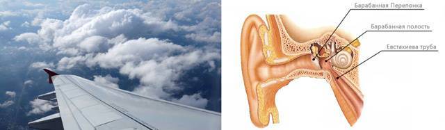 Боль в ушах в самолёте. лечение в клинике «эхинацея» - медицинский центр «эхинацея»